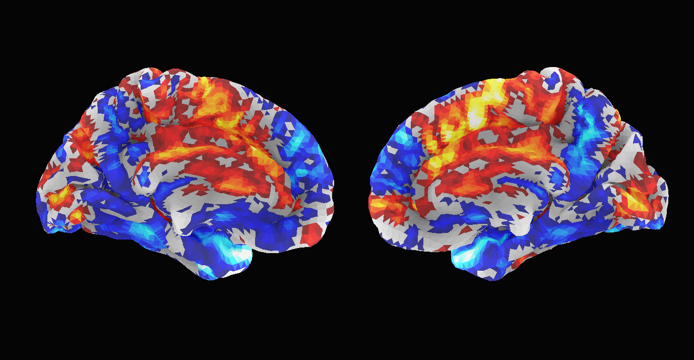 Default-mode self-reference cortical activation pattern