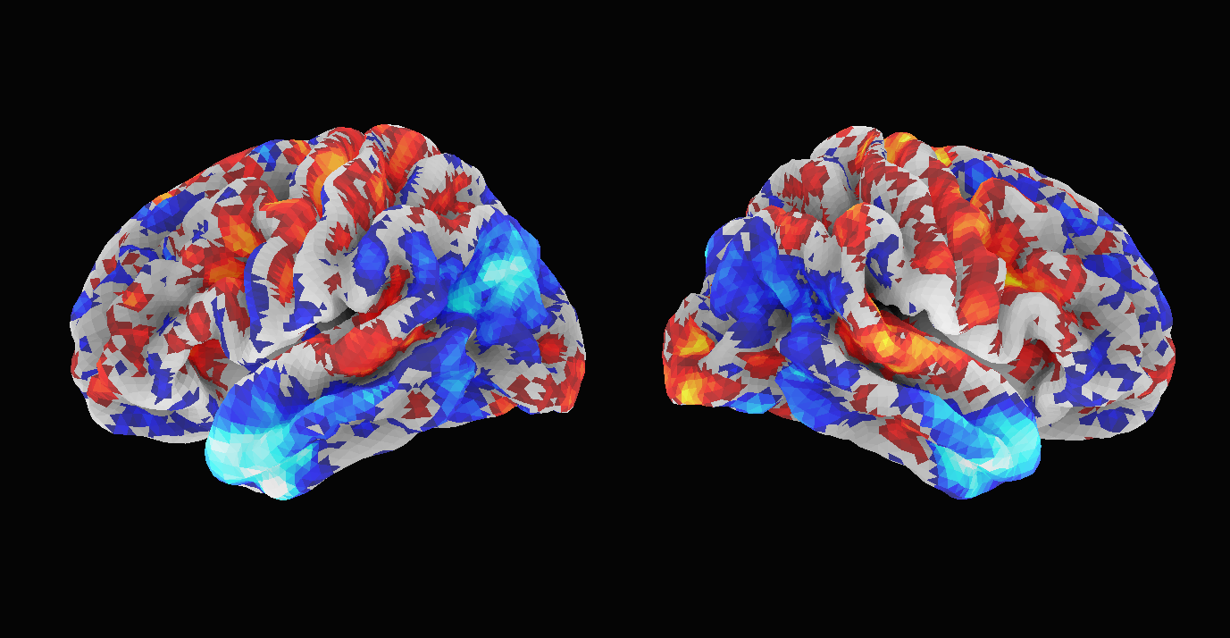 Dorsal attention and motor cortical activation pattern
